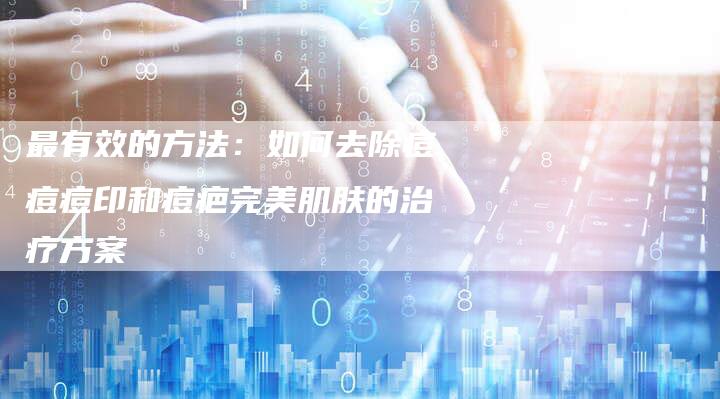最有效的方法:如何去除痘痘痘印和痘疤完美肌肤的治疗方案-链接买卖平台